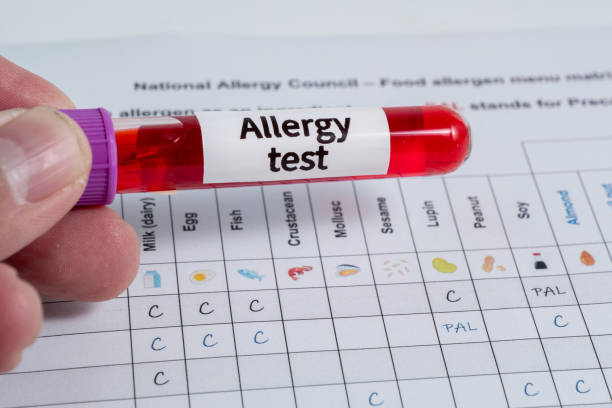 Allergy Testing
